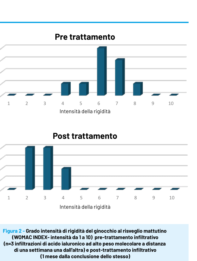 Grafici a barre del numero di pazienti per intensità della rigidità del ginocchio al risveglio mattutino (scala 1-10) prima e dopo il ciclo di infiltrazioni: pre-trattamento concentrato sui valori 6-8, post-trattamento spostato sui valori 2-4.