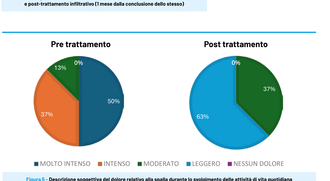 Due grafici a torta (questionario SPADI) sulla descrizione soggettiva del dolore alla spalla durante le attività quotidiane: pre-trattamento con 50% «molto intenso», 37% «intenso», 13% «moderato»; post-trattamento con 63% «leggero» e 37% «moderato».